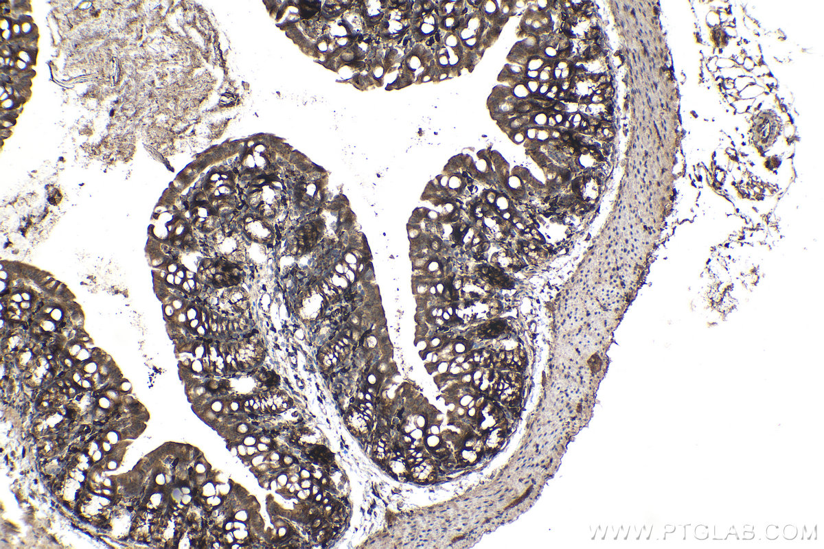 Immunohistochemical analysis of paraffin-embedded mouse colon tissue slide using KHC0979 (SNX5 IHC Kit).