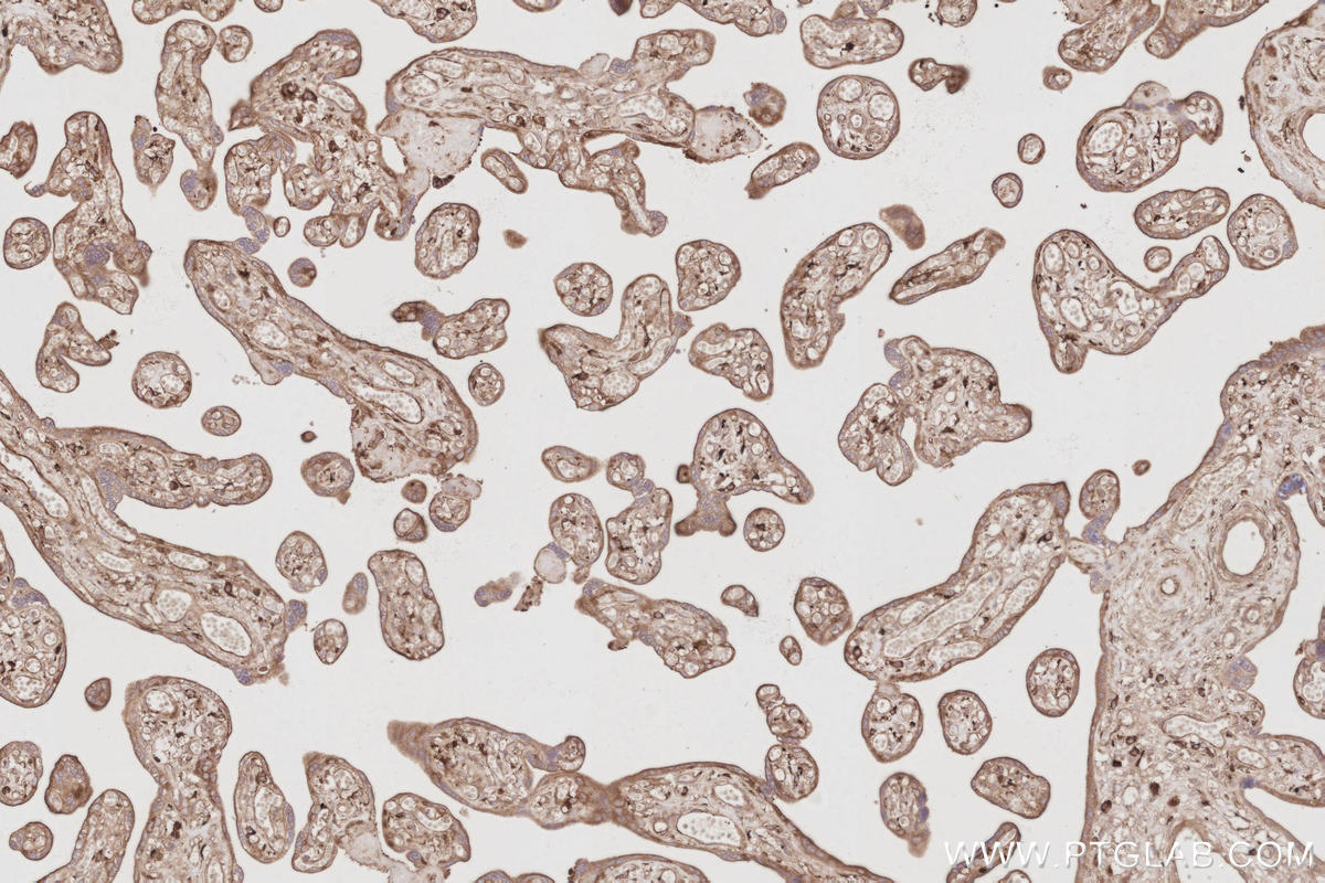 Immunohistochemical analysis of paraffin-embedded human placenta tissue slide using KHC3084 (SNX9 IHC Kit).