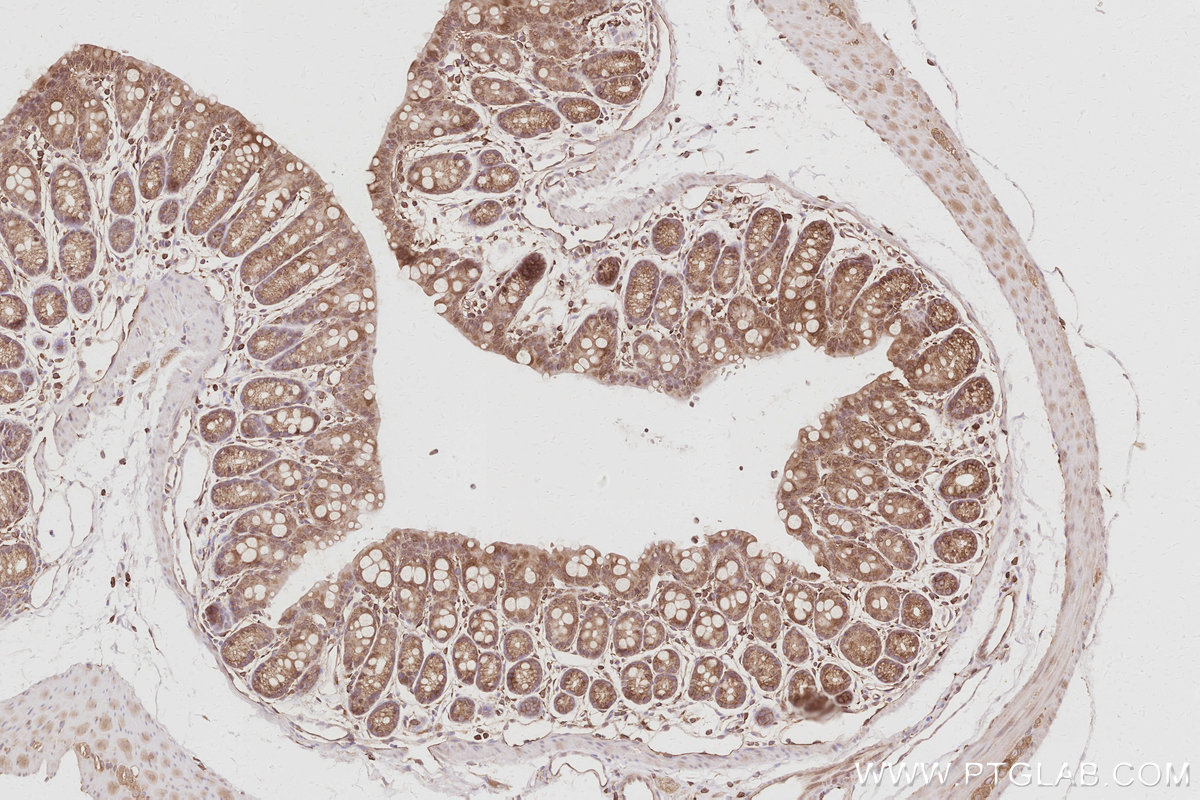 Immunohistochemical analysis of paraffin-embedded mouse colon tissue slide using KHC3084 (SNX9 IHC Kit).