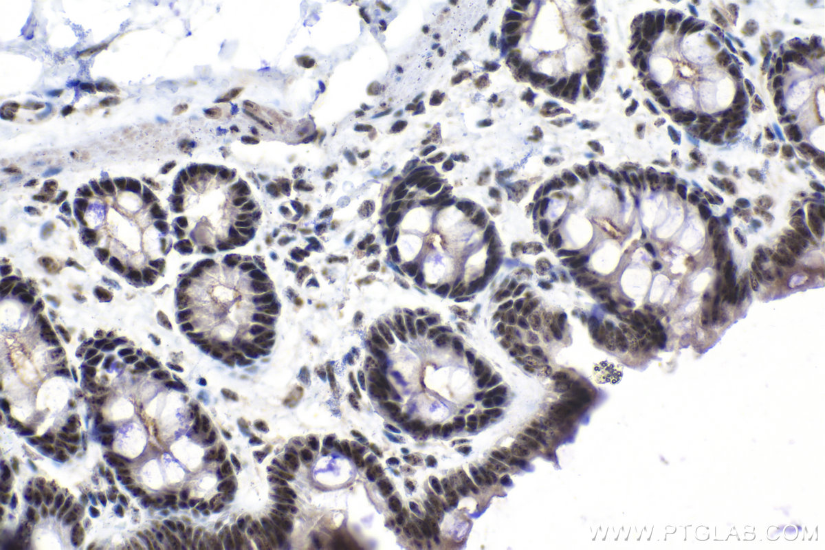 Immunohistochemical analysis of paraffin-embedded rat colon tissue slide using KHC1555 (SON IHC Kit).