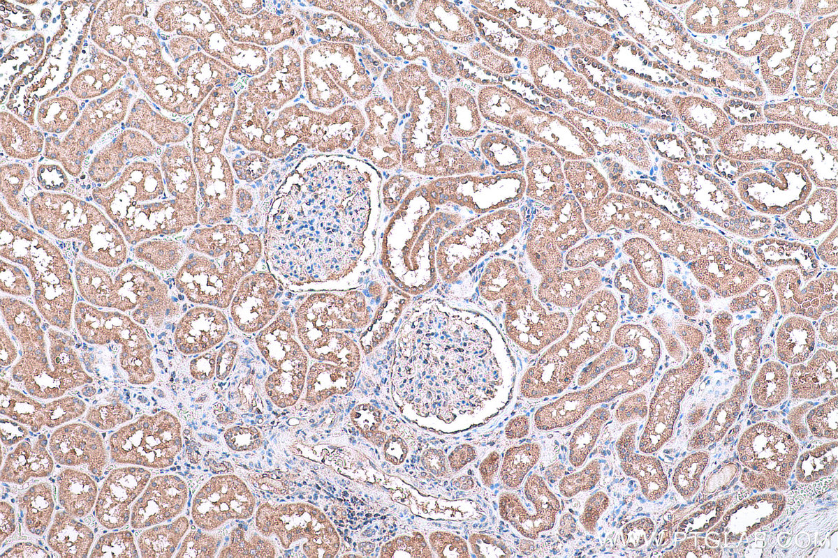 Immunohistochemical analysis of paraffin-embedded human kidney tissue slide using KHC0829 (SORBS2 IHC Kit).