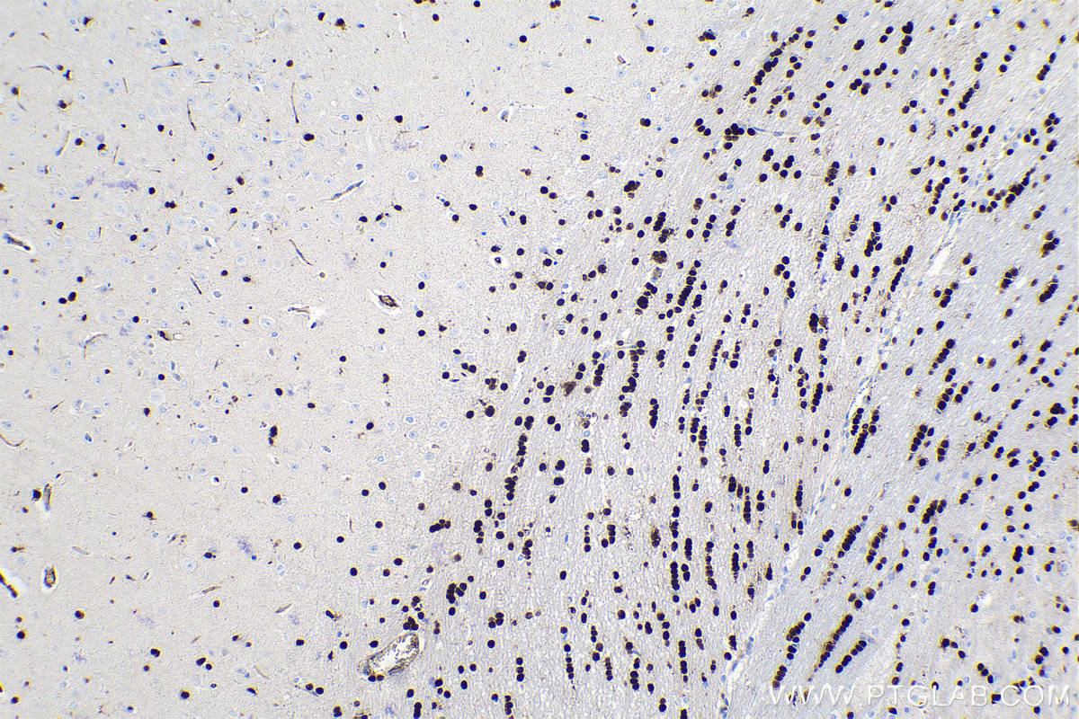 Immunohistochemical analysis of paraffin-embedded rat brain tissue slide using KHC0273 (SOX10 IHC Kit).