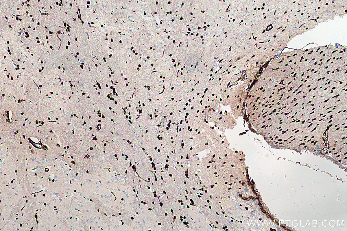 Immunohistochemical analysis of paraffin-embedded mouse brain tissue slide using KHC0273 (SOX10 IHC Kit).