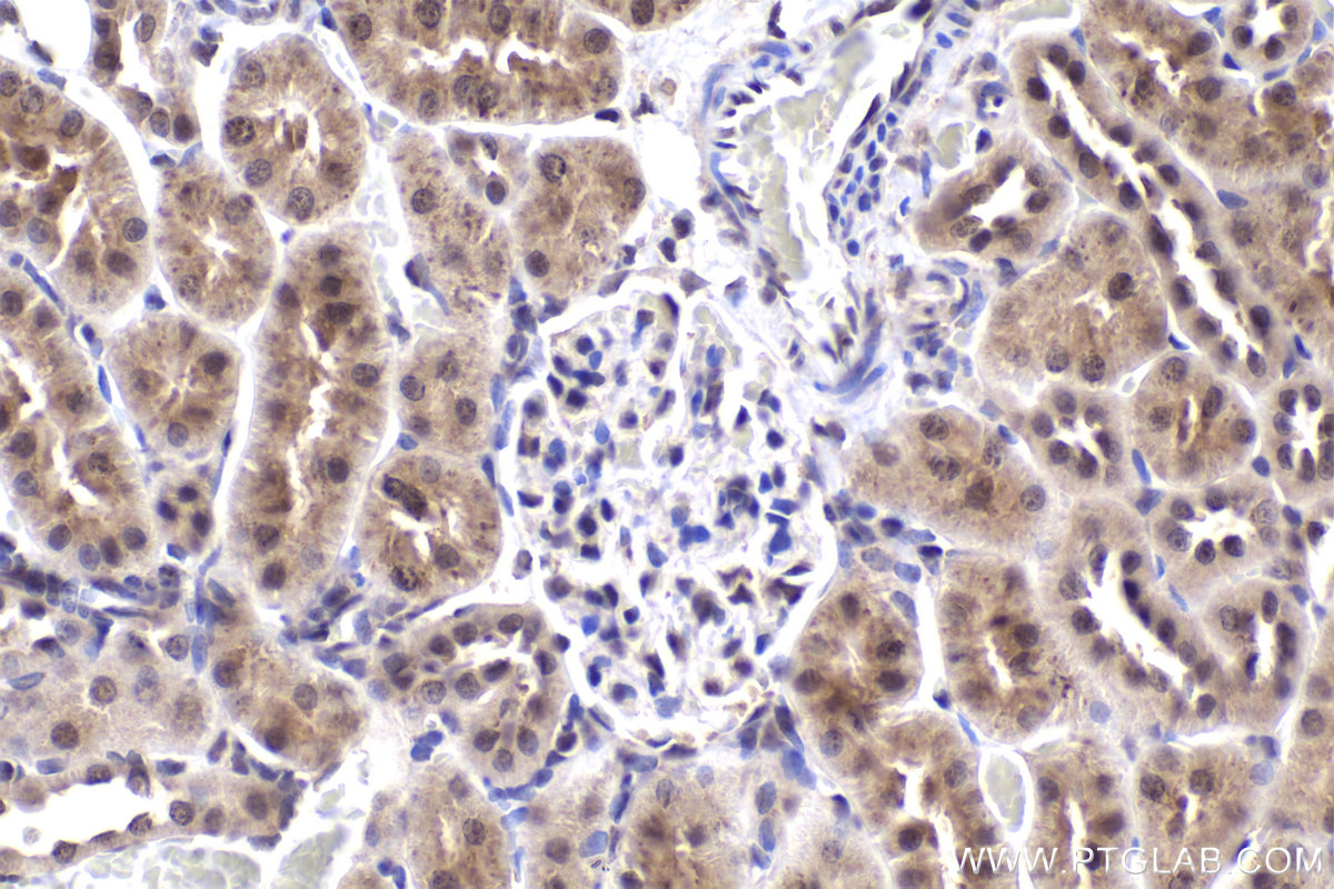 Immunohistochemical analysis of paraffin-embedded rat kidney tissue slide using KHC2002 (SOX13 IHC Kit).