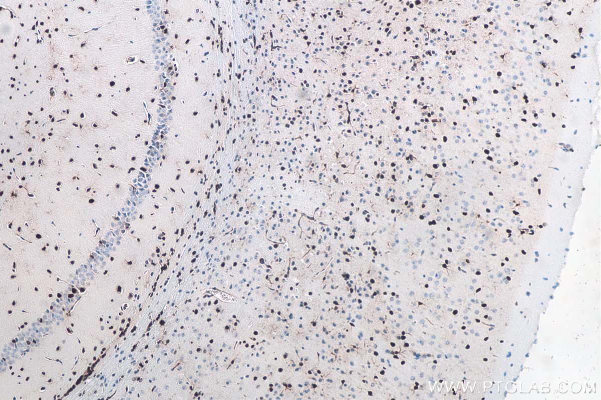 Immunohistochemical analysis of paraffin-embedded mouse brain tissue slide using KHC0294 (SOX2 IHC Kit).