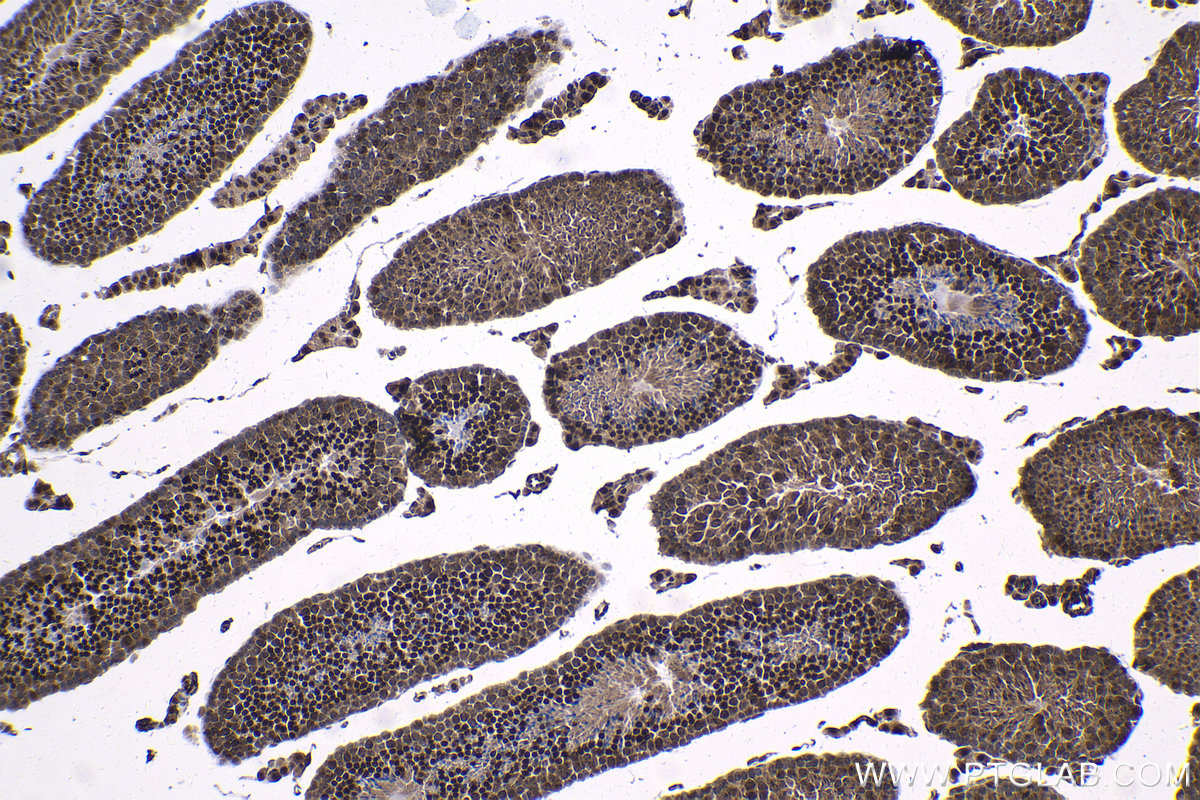 Immunohistochemical analysis of paraffin-embedded mouse testis tissue slide using KHC1337 (SOX6 IHC Kit).