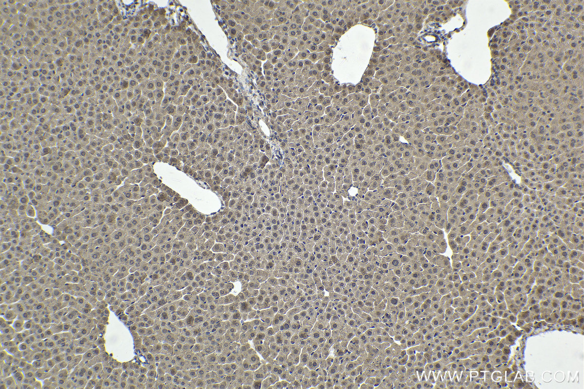 Immunohistochemical analysis of paraffin-embedded mouse liver tissue slide using KHC1903 (SOX7 IHC Kit).