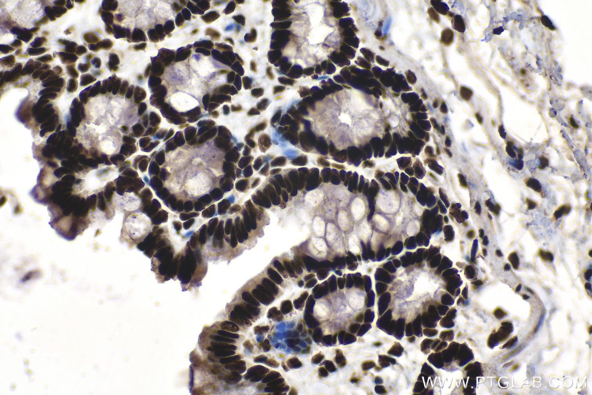 Immunohistochemical analysis of paraffin-embedded rat colon tissue slide using KHC1513 (SP1 IHC Kit).