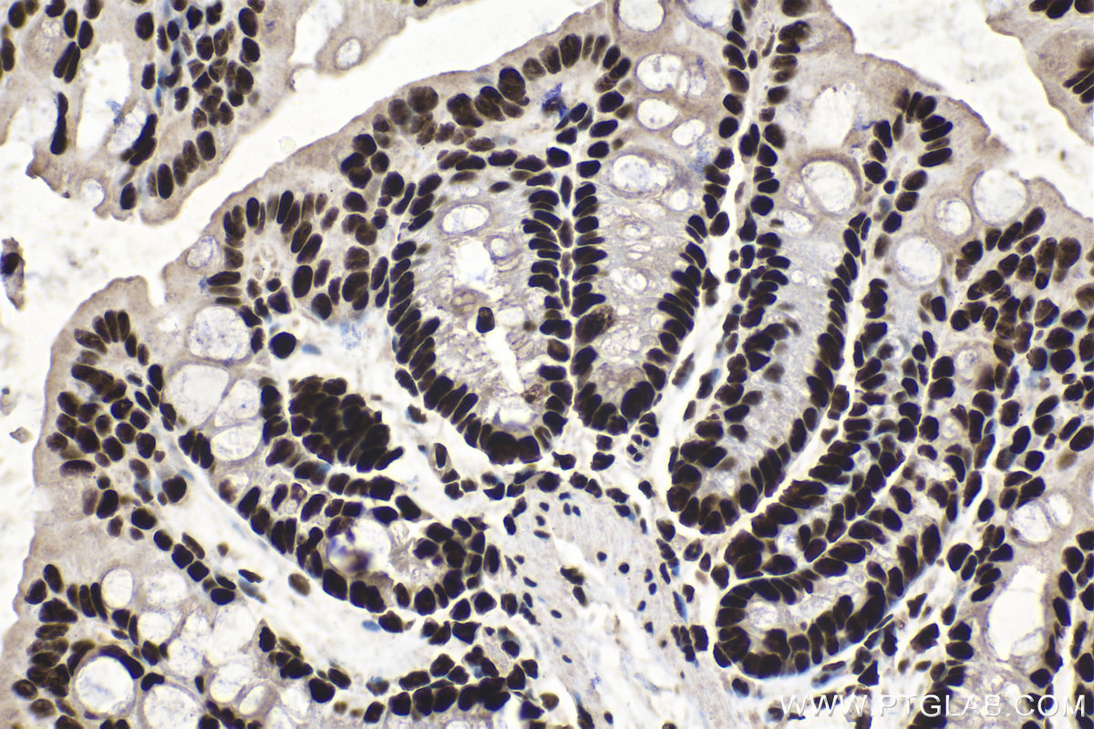 Immunohistochemical analysis of paraffin-embedded mouse colon tissue slide using KHC1513 (SP1 IHC Kit).
