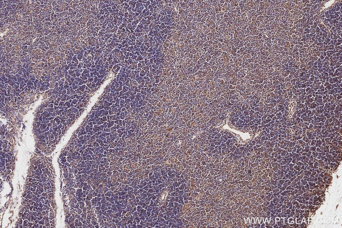 Immunohistochemical analysis of paraffin-embedded mouse thymus tissue slide using KHC2824 (SPAG5 IHC Kit).