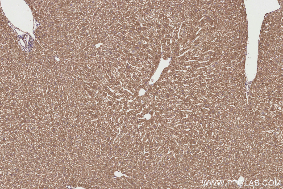 Immunohistochemical analysis of paraffin-embedded mouse liver tissue slide using KHC2824 (SPAG5 IHC Kit).
