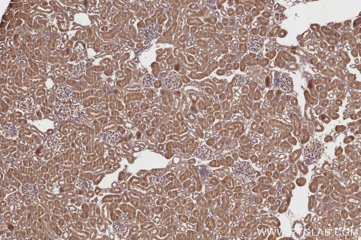 Immunohistochemical analysis of paraffin-embedded mouse kidney tissue slide using KHC2824 (SPAG5 IHC Kit).