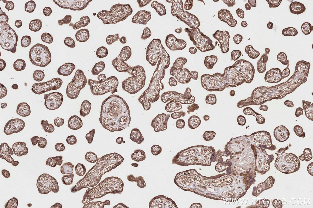 Immunohistochemical analysis of paraffin-embedded human placenta tissue slide using KHC2824 (SPAG5 IHC Kit).