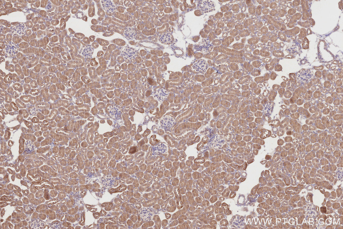 Immunohistochemical analysis of paraffin-embedded mouse kidney tissue slide using KHC2837 (SPATA13 IHC Kit).