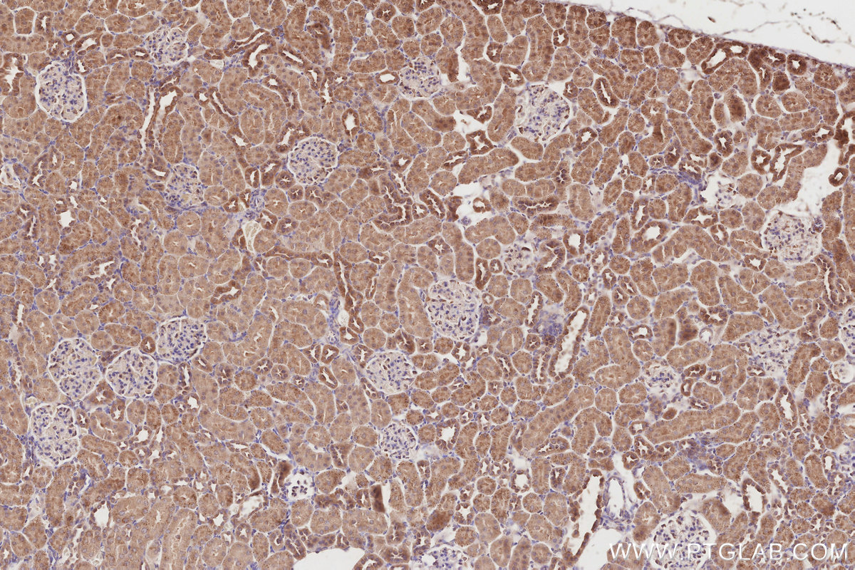 Immunohistochemical analysis of paraffin-embedded rat kidney tissue slide using KHC2837 (SPATA13 IHC Kit).