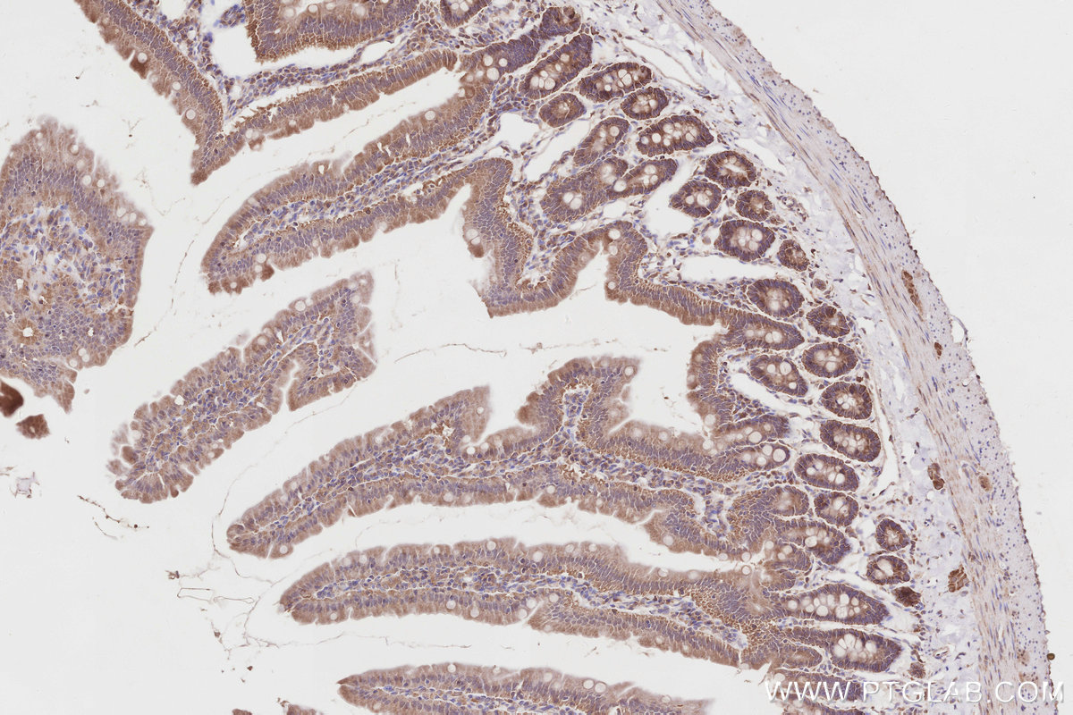 Immunohistochemical analysis of paraffin-embedded rat small intestine tissue slide using KHC2837 (SPATA13 IHC Kit).