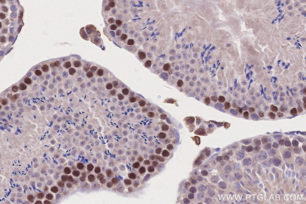 Immunohistochemical analysis of paraffin-embedded mouse testis tissue slide using KHC2701 (SPATA22 IHC Kit).