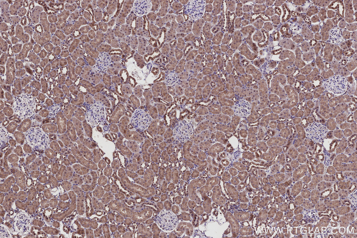 Immunohistochemical analysis of paraffin-embedded rat kidney tissue slide using KHC2930 (SPC25 IHC Kit).
