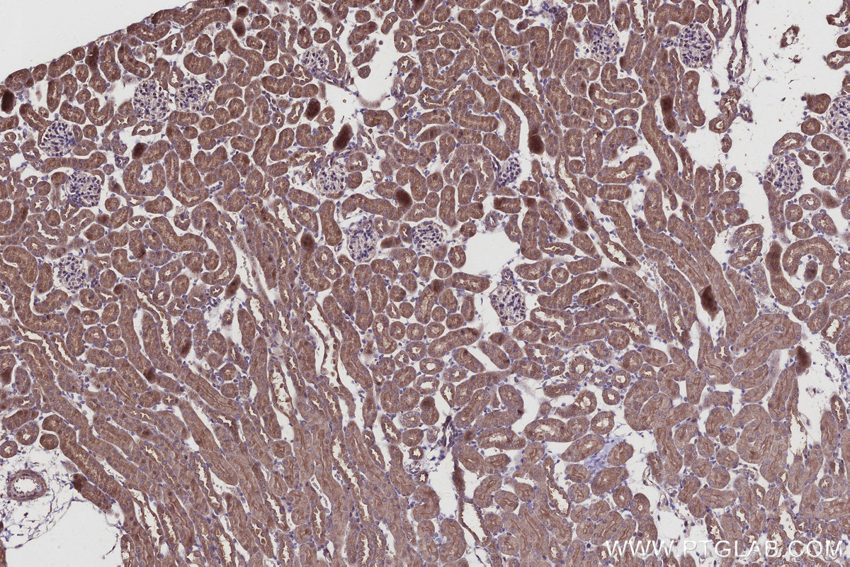 Immunohistochemical analysis of paraffin-embedded mouse kidney tissue slide using KHC2930 (SPC25 IHC Kit).
