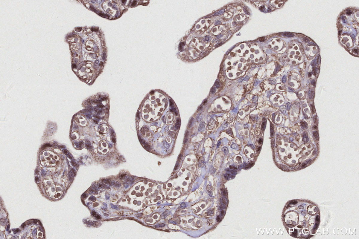Immunohistochemical analysis of paraffin-embedded human placenta tissue slide using KHC2930 (SPC25 IHC Kit).