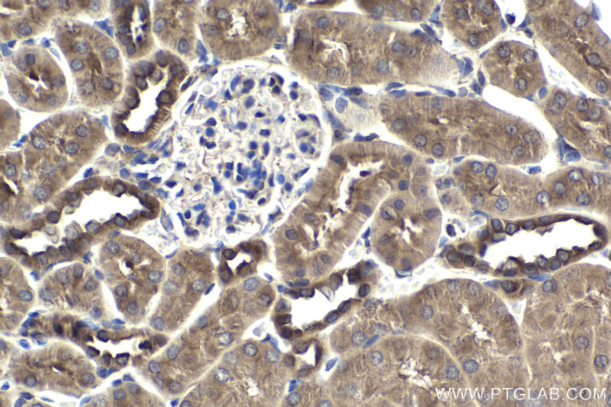 Immunohistochemical analysis of paraffin-embedded rat kidney tissue slide using KHC1961 (SPHK2 IHC Kit).