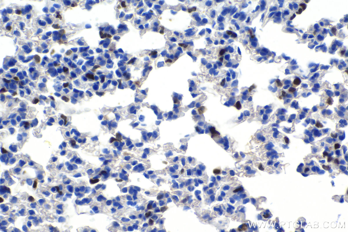 Immunohistochemical analysis of paraffin-embedded mouse lung tissue slide using KHC1149 (SPI1 IHC Kit).