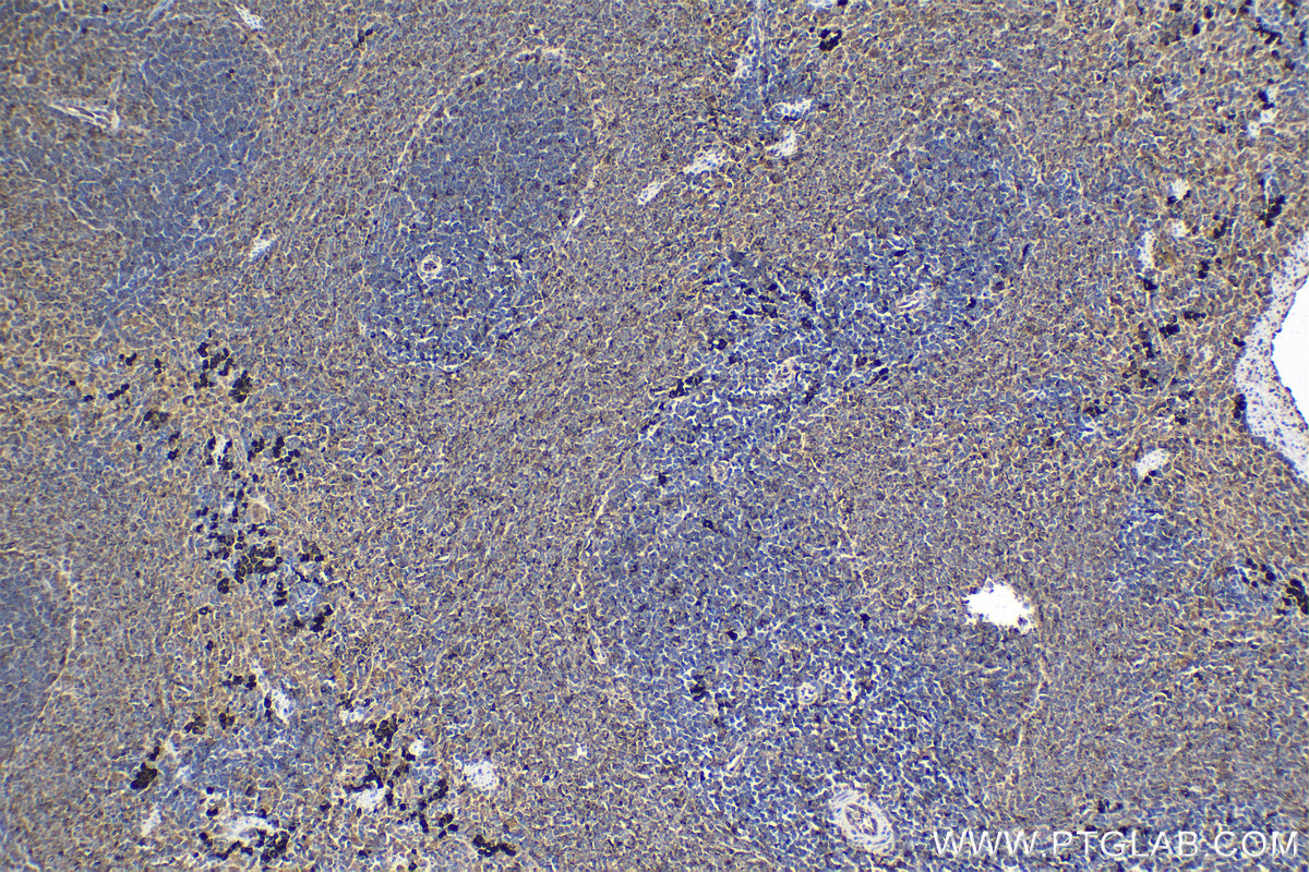 Immunohistochemical analysis of paraffin-embedded rat spleen tissue slide using KHC1668 (SPIB IHC Kit).