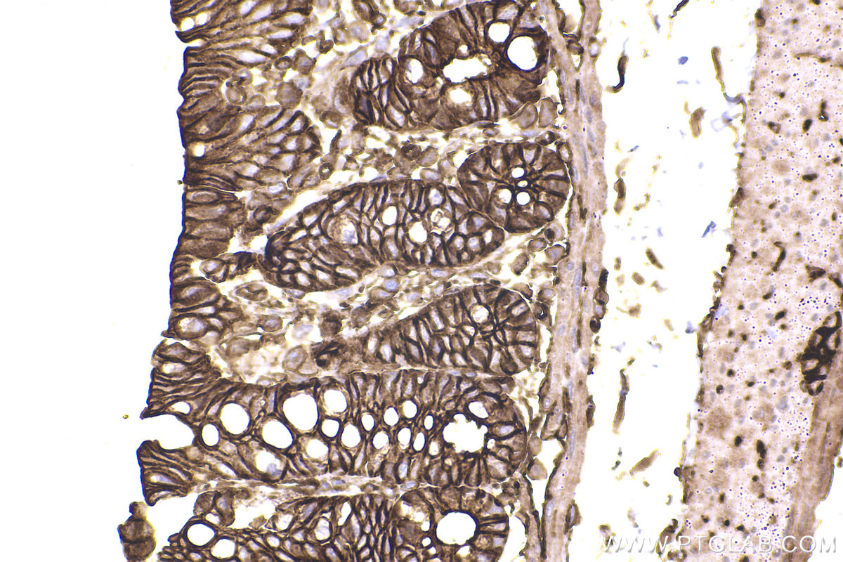 Immunohistochemical analysis of paraffin-embedded rat colon tissue slide using KHC2442 (SPTAN1 IHC Kit).