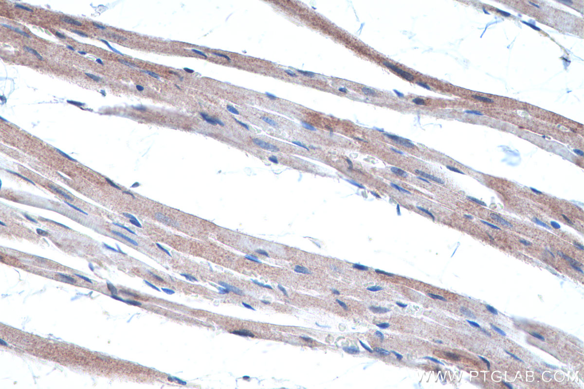 Immunohistochemical analysis of paraffin-embedded rat heart tissue slide using KHC0301 (SPTB IHC Kit).