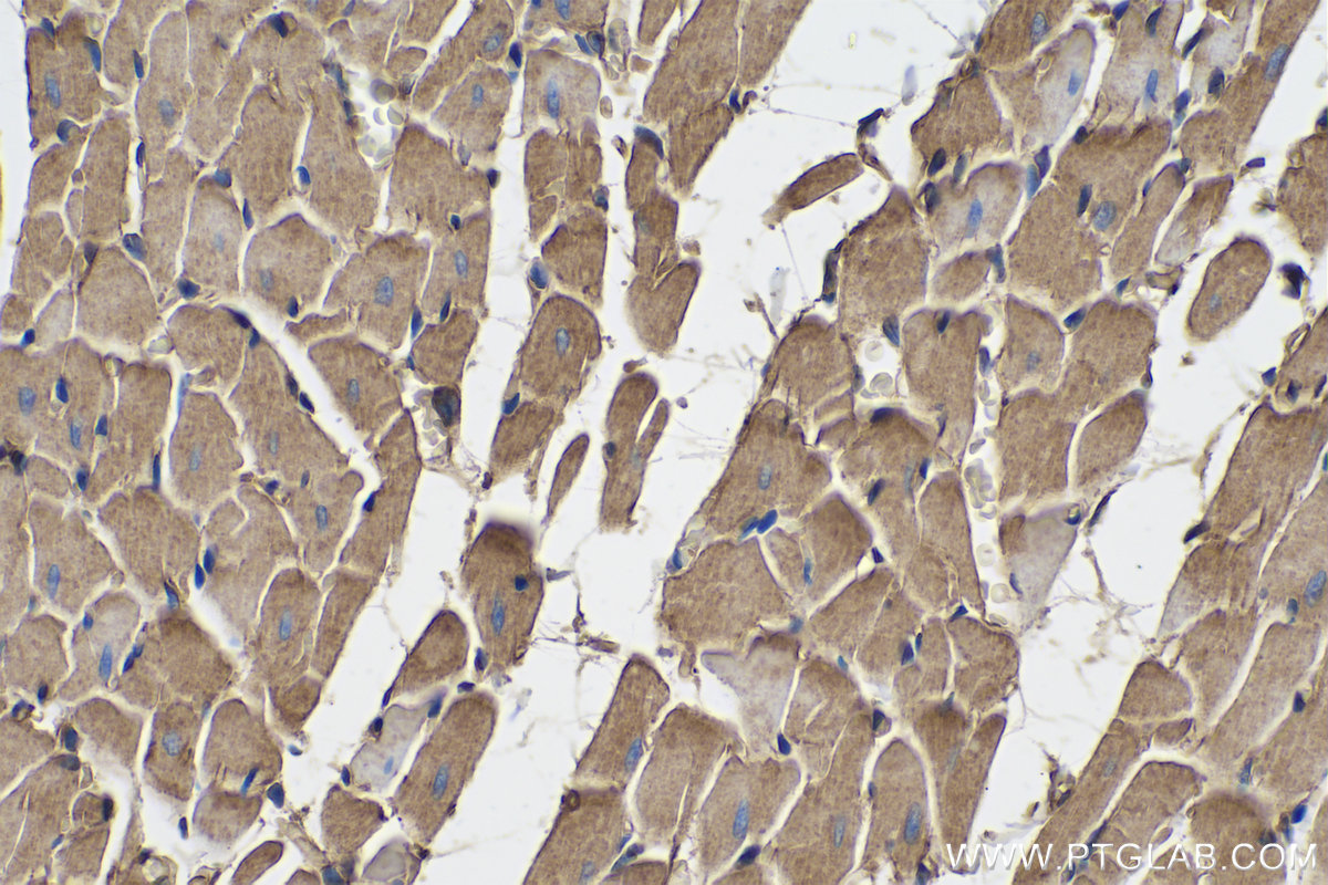 Immunohistochemical analysis of paraffin-embedded rat heart tissue slide using KHC0283 (SPTBN1 IHC Kit).