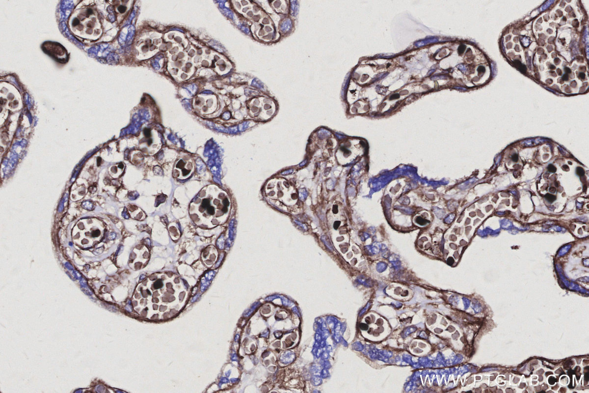 Immunohistochemical analysis of paraffin-embedded human placenta tissue slide using KHC3138 (SPTLC2 IHC Kit). Immunohistochemical analysis of paraffin-embedded human placenta tissue slide using KHC3138 (SPTLC2 IHC Kit).