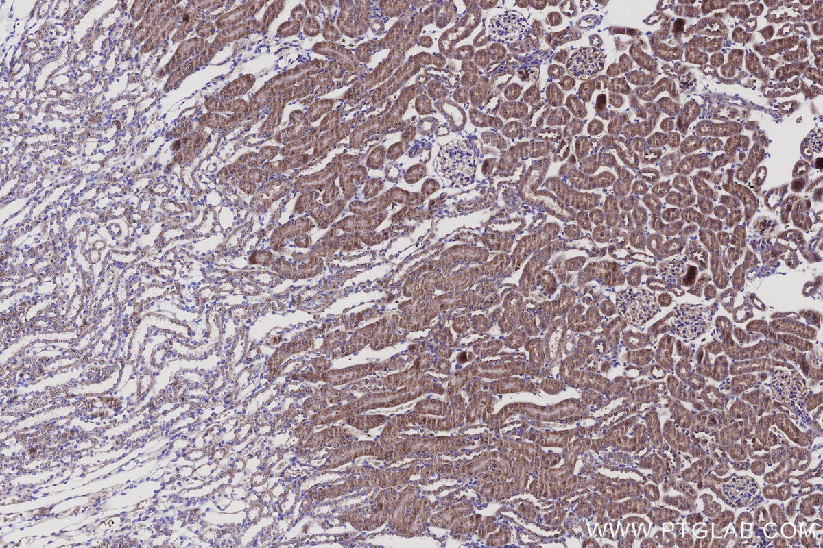 Immunohistochemical analysis of paraffin-embedded mouse kidney tissue slide using KHC3138 (SPTLC2 IHC Kit). Immunohistochemical analysis of paraffin-embedded mouse kidney tissue slide using KHC3138 (SPTLC2 IHC Kit).