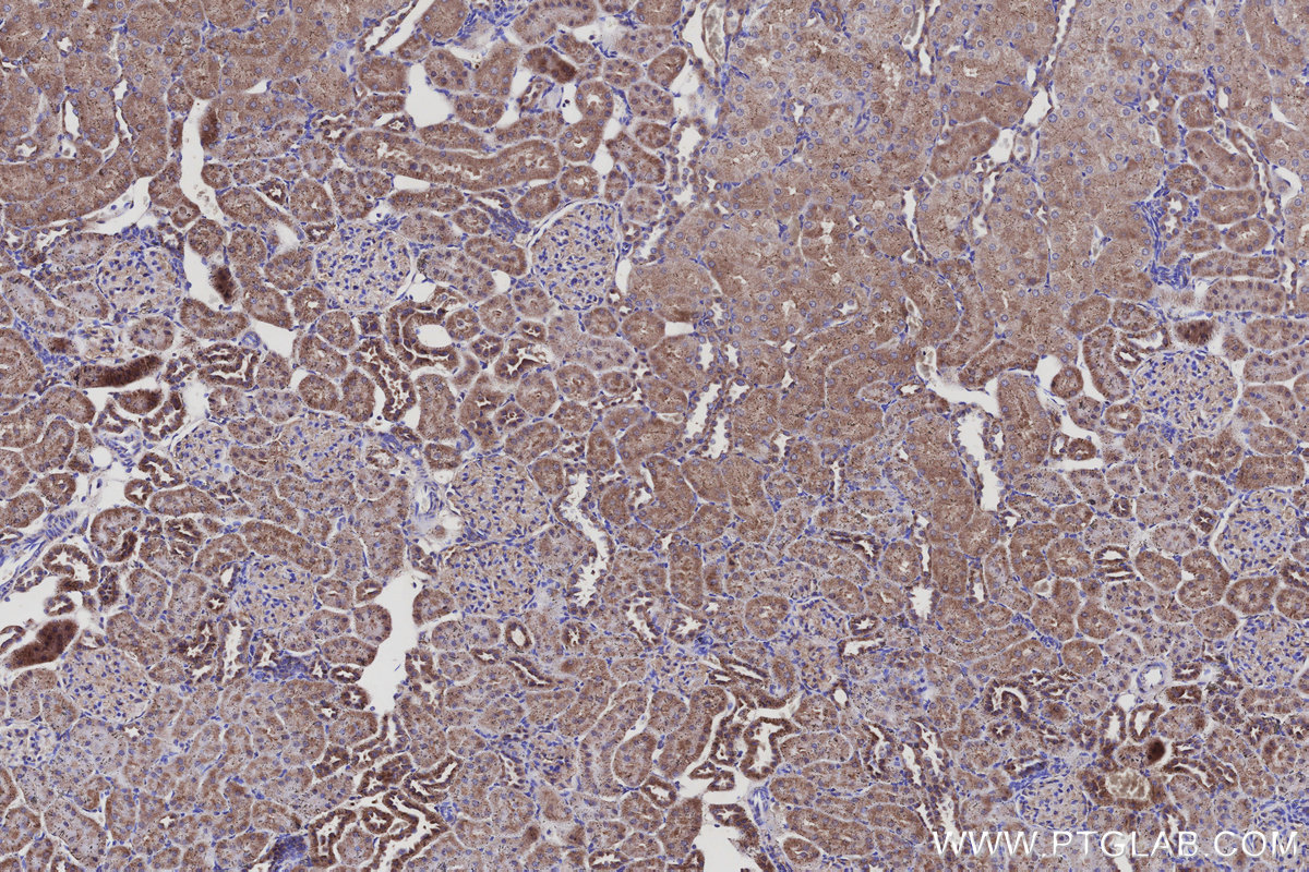 Immunohistochemical analysis of paraffin-embedded rat kidney tissue slide using KHC3138 (SPTLC2 IHC Kit). Immunohistochemical analysis of paraffin-embedded rat kidney tissue slide using KHC3138 (SPTLC2 IHC Kit).