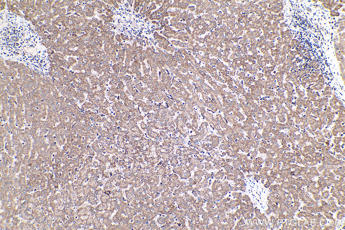 Immunohistochemical analysis of paraffin-embedded human liver tissue slide using KHC0466 (SQRDL IHC Kit).