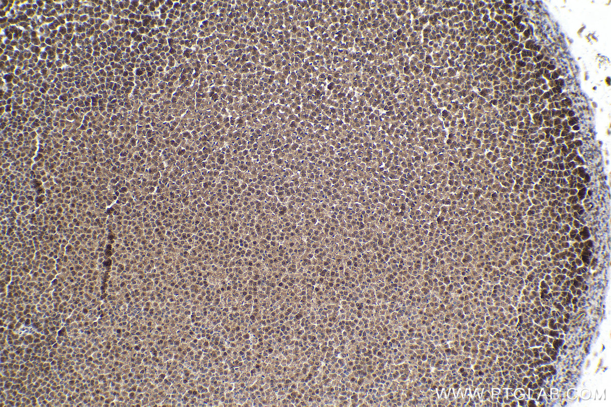 Immunohistochemical analysis of paraffin-embedded rat adrenal gland tissue slide using KHC1587 (SREBF1 IHC Kit).