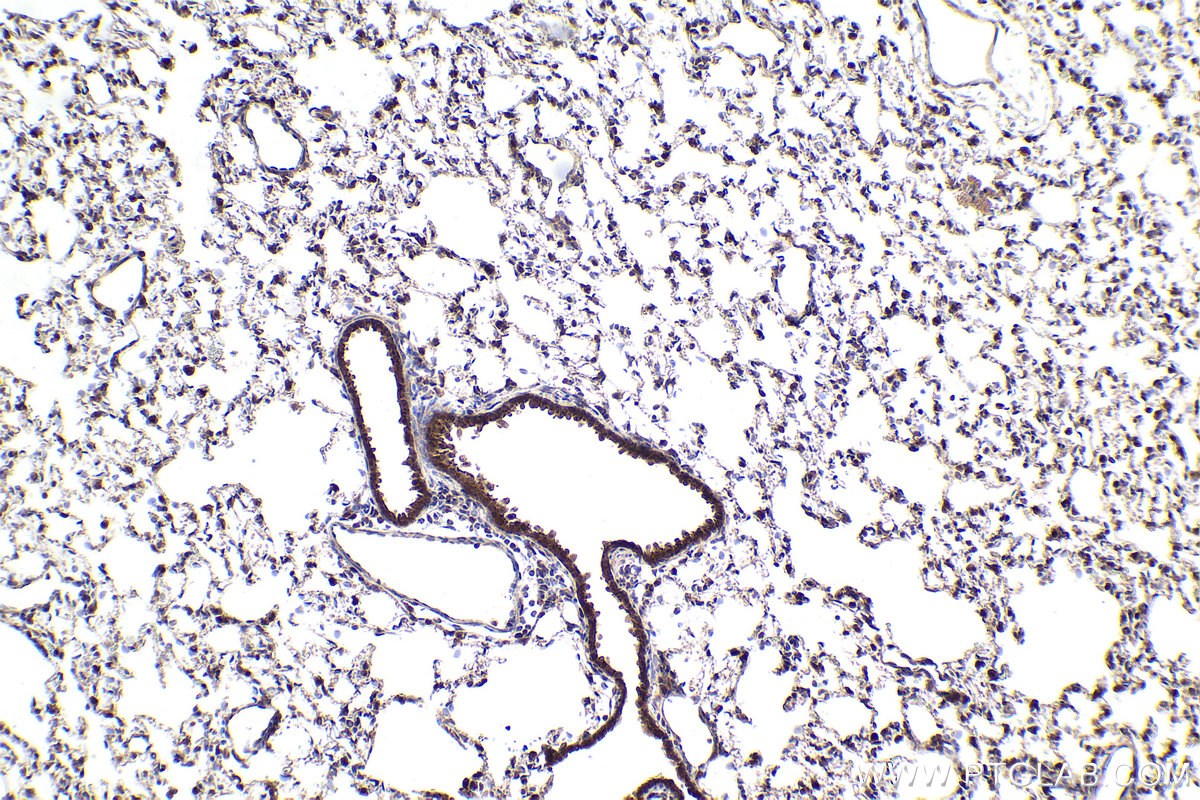 Immunohistochemical analysis of paraffin-embedded rat lung tissue slide using KHC1587 (SREBF1 IHC Kit).