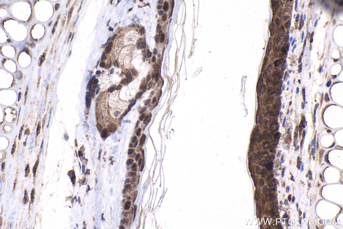 Immunohistochemical analysis of paraffin-embedded mouse skin tissue slide using KHC1689 (SREBF2 IHC Kit).