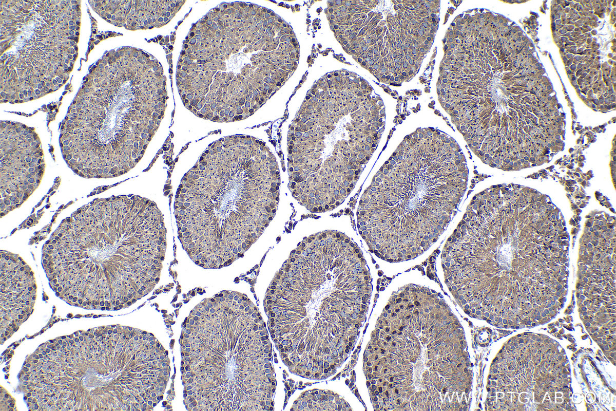 Immunohistochemical analysis of paraffin-embedded rat testis tissue slide using KHC1283 (SRGAP1 IHC Kit).
