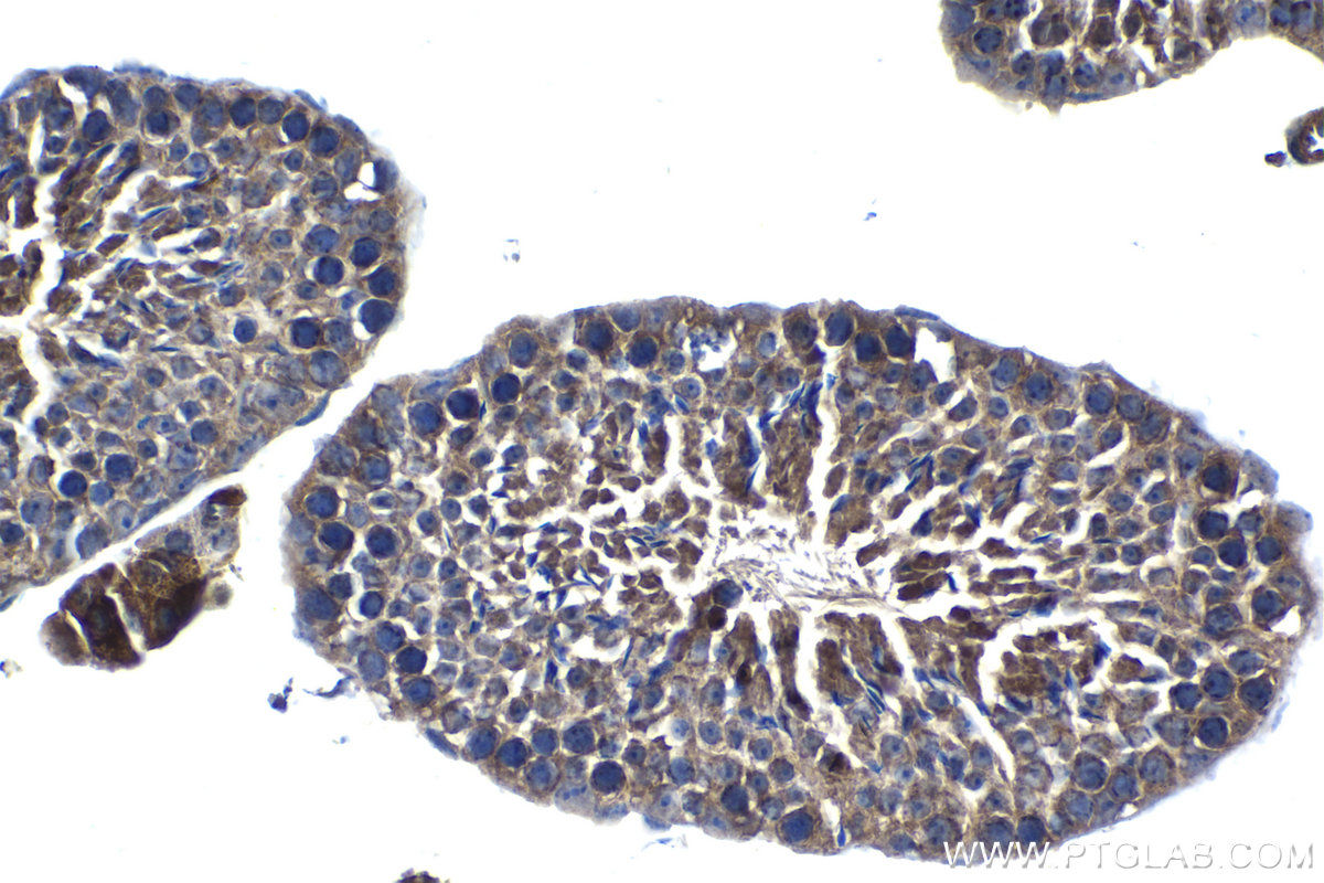 Immunohistochemical analysis of paraffin-embedded mouse testis tissue slide using KHC1283 (SRGAP1 IHC Kit).
