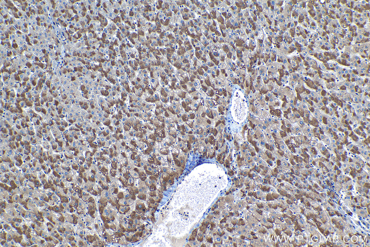 Immunohistochemical analysis of paraffin-embedded human liver tissue slide using KHC1283 (SRGAP1 IHC Kit).