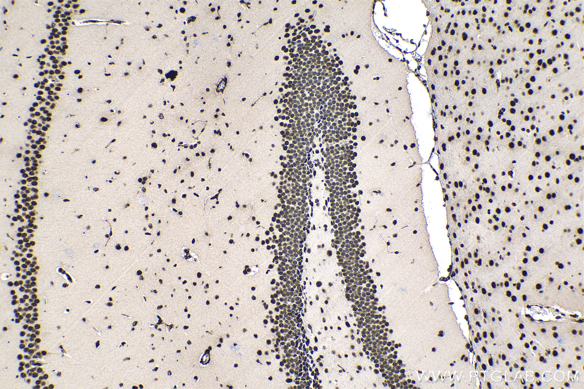 Immunohistochemical analysis of paraffin-embedded mouse brain tissue slide using KHC1396 (SRSF1 IHC Kit).
