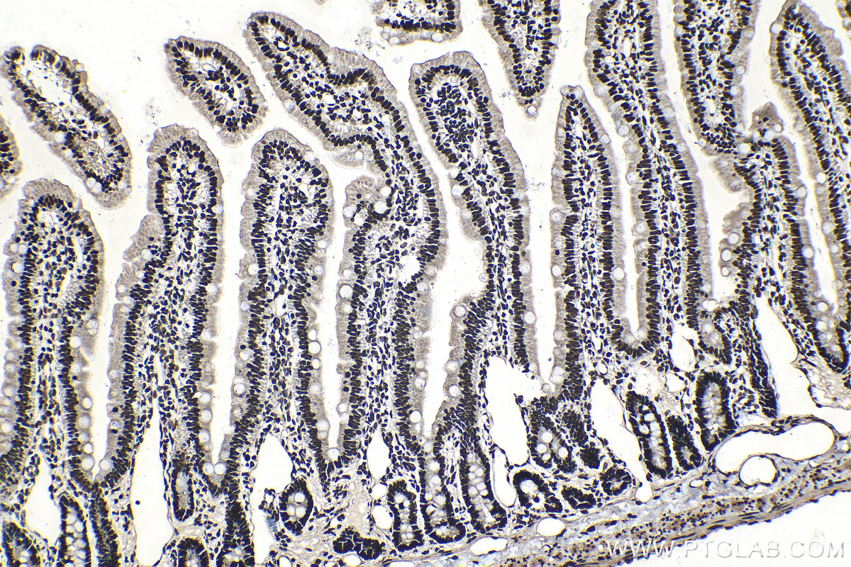 Immunohistochemical analysis of paraffin-embedded rat small intestine tissue slide using KHC1396 (SRSF1 IHC Kit).