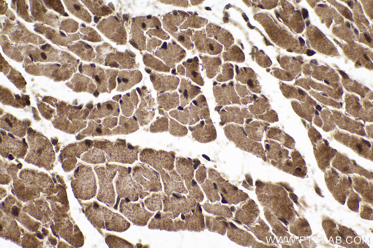 Immunohistochemical analysis of paraffin-embedded mouse heart tissue slide using KHC0730 (SRSF3 IHC Kit).