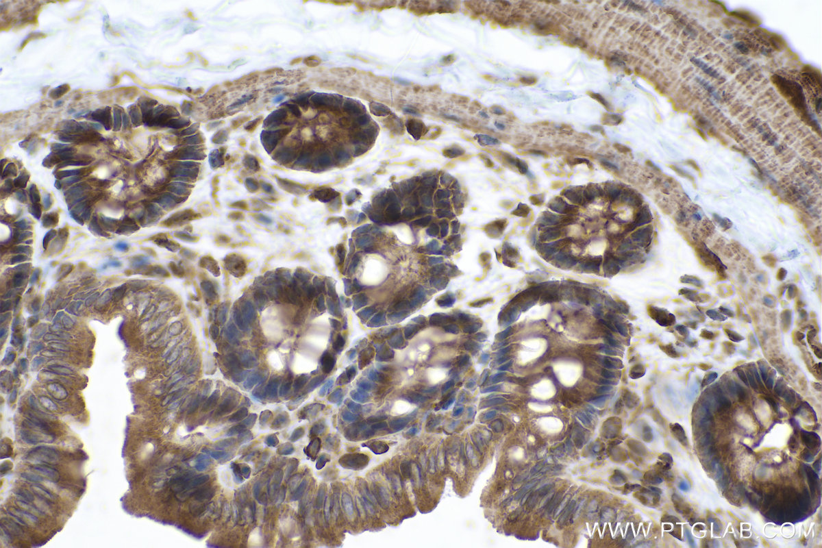 Immunohistochemical analysis of paraffin-embedded rat colon tissue slide using KHC0849 (ST13 IHC Kit).