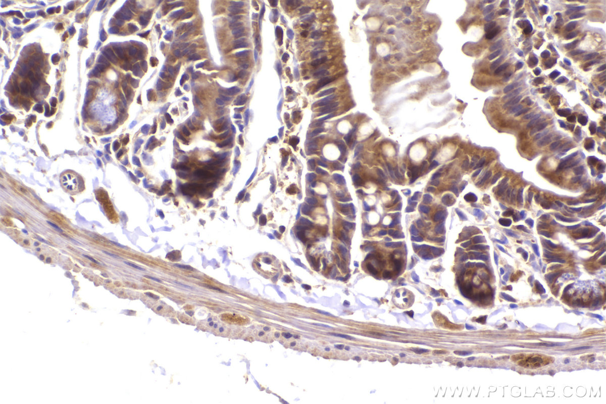 Immunohistochemical analysis of paraffin-embedded mouse small intestine tissue slide using KHC2949 (ST7 IHC Kit).