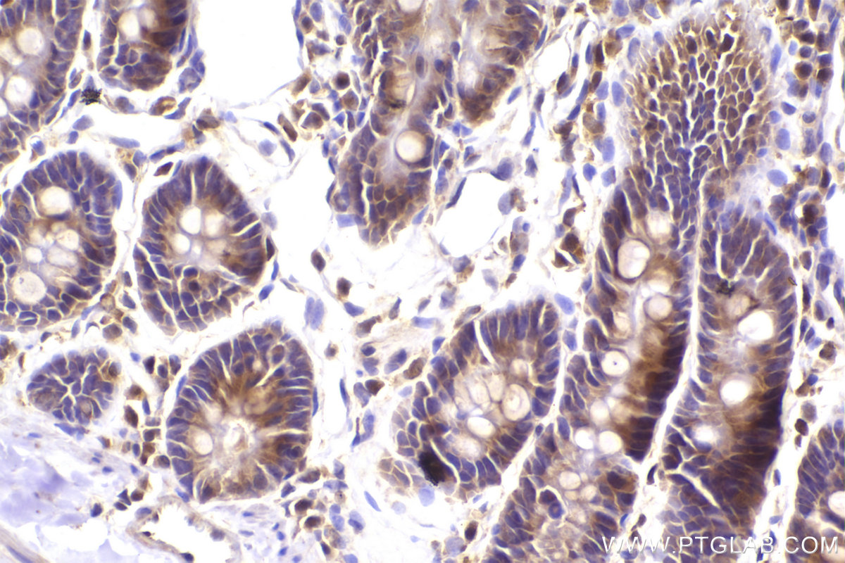 Immunohistochemical analysis of paraffin-embedded rat small intestine tissue slide using KHC2949 (ST7 IHC Kit).