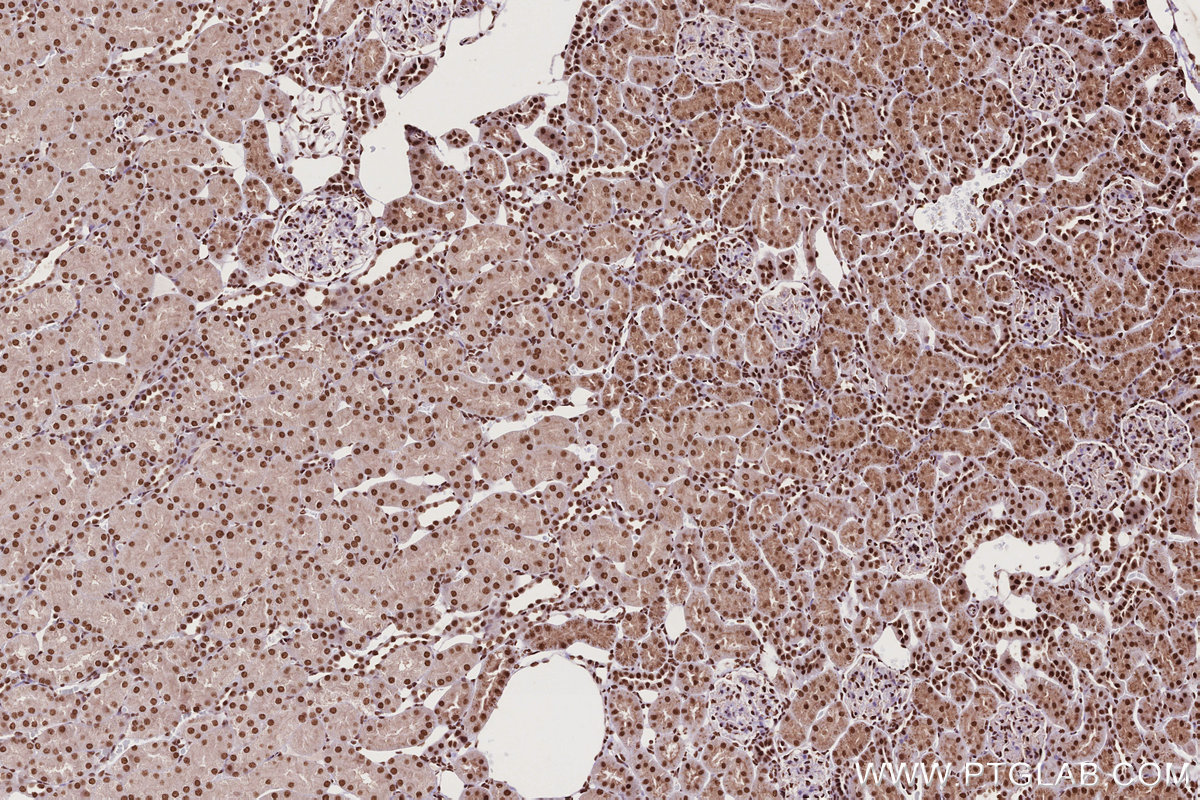 Immunohistochemical analysis of paraffin-embedded rat kidney tissue slide using KHC2735 (STAG1 IHC Kit).