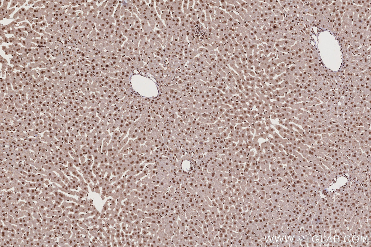 Immunohistochemical analysis of paraffin-embedded rat liver tissue slide using KHC2735 (STAG1 IHC Kit).