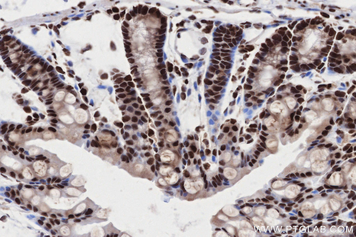 Immunohistochemical analysis of paraffin-embedded mouse colon tissue slide using KHC2673 (STAG2 IHC Kit).