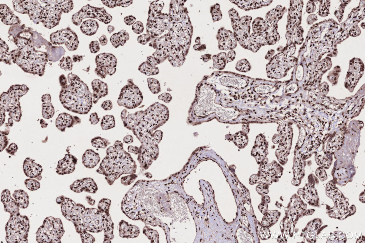 Immunohistochemical analysis of paraffin-embedded human placenta tissue slide using KHC2673 (STAG2 IHC Kit).